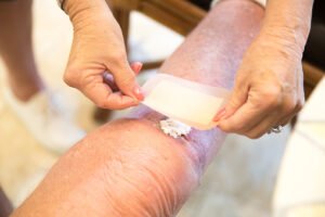 Plaie au niveau de la jambe avec pansement pour la couvrir