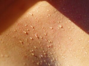 Gouttes de transpiration qui risquent d'entrainer les crampes musculaires